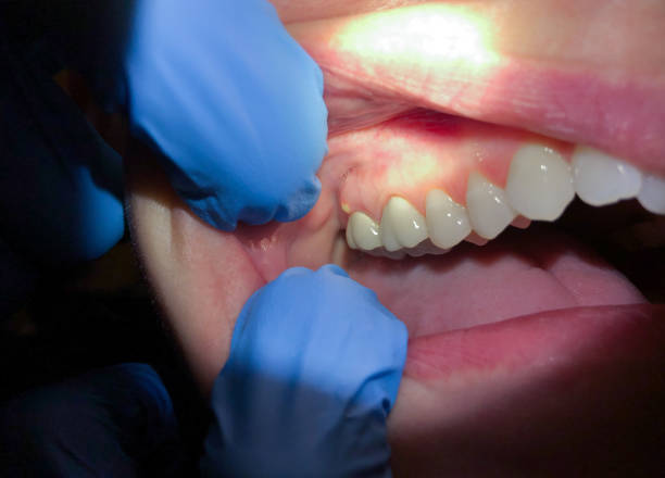 Best Emergency Gum Treatment in Franklin, GA